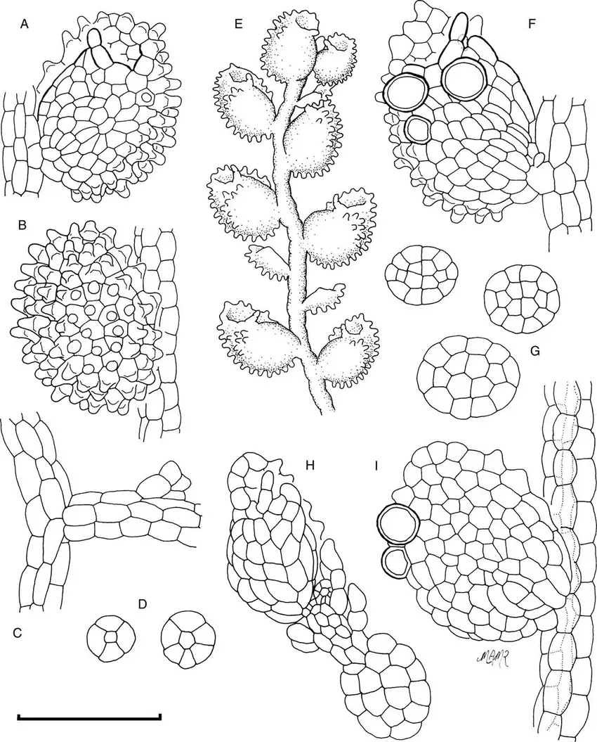 Cololejeunea-grossepapillosa-A-Ventral-view-of-leaf-B-Dorsal-view-of-leaf-C-Athecal.png