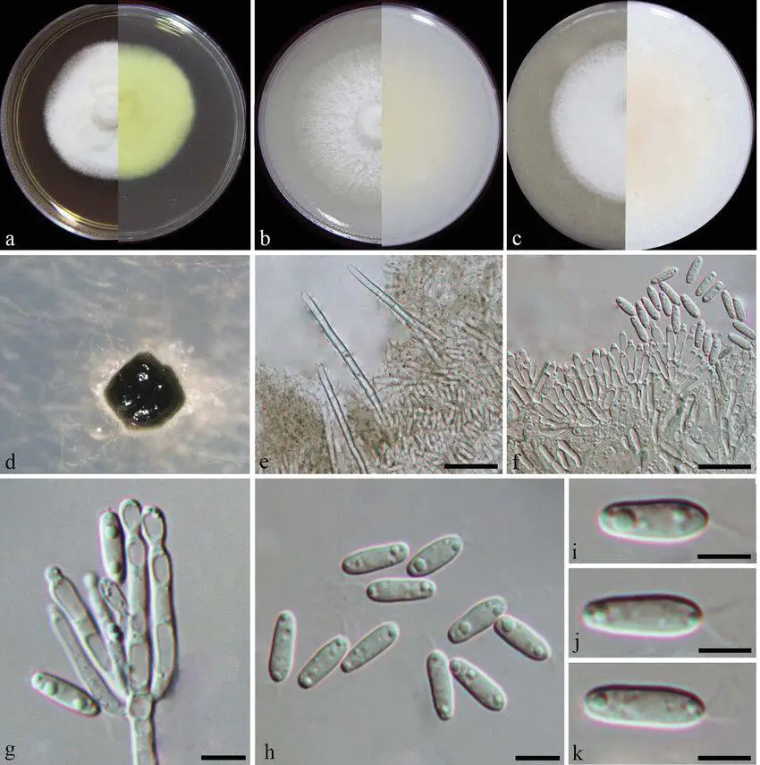 Dimorphiseta-acuta-from-ex-type-strain-CGMCC319208-a-c-colony-on-PDA-CMA-OA-d.png