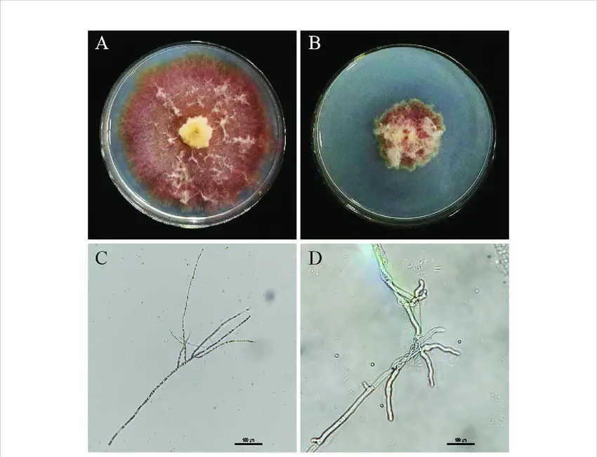 Effect-of-culture-broth-on-mycelium-morphology-A-F-graminearum-growth-alone-B-The.png