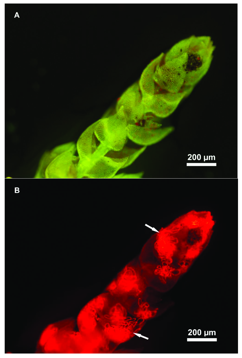 Epifluorescence-microscopy-image-of-one-shoot-of-Thuidium-peruvianum-moss-collected-in-a.png