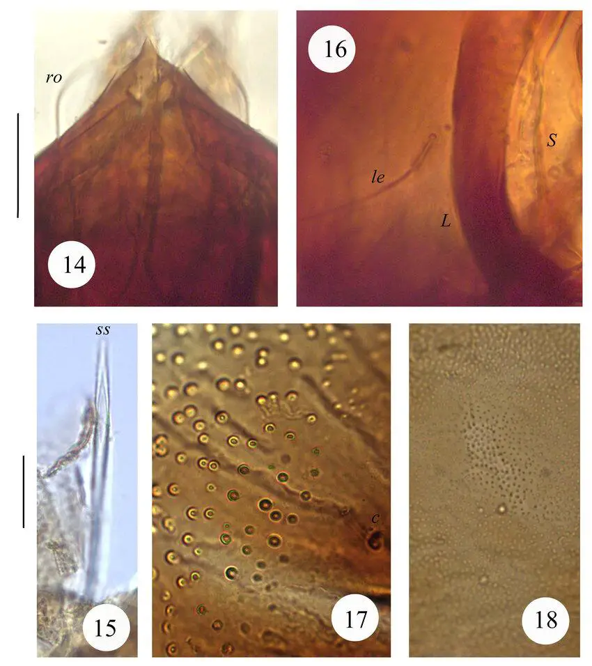FIGURES-14-18-Carinogalumna-philippinensis-sp-nov-adult-brightfield-micrographs.png
