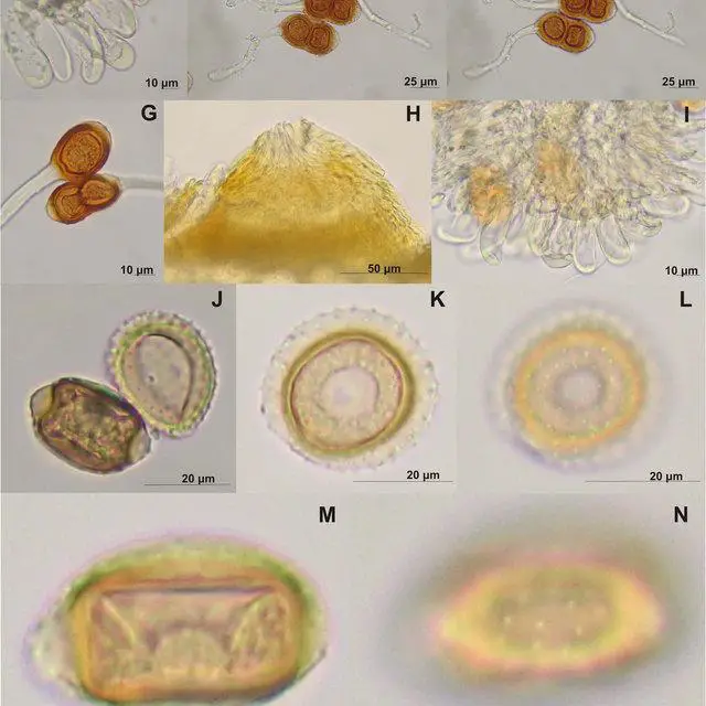 Figura-2-A-G-Prospodium-appendiculatum-sobre-Tecoma-stans-A-espermogonio-B-C_Q640.jpg