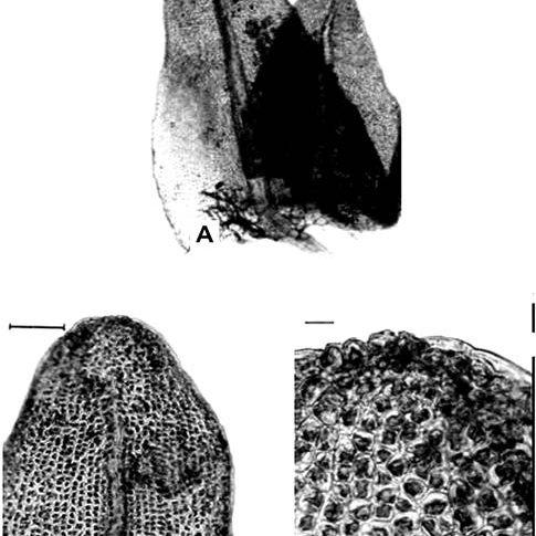 Figura-2-Helicophyllum-torquatum-Hook-Brid-A-Filidios-maior-oblongo-lingulado-e_Q640.jpg