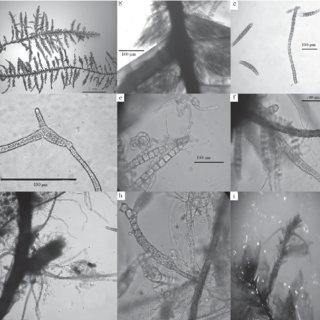 Figura-5-Calyptothecium-duplicatulum-a-Aspecto-de-la-planta-b-propagulos-c-d_Q320.jpg
