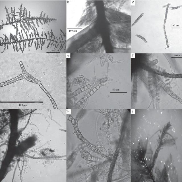 Figura-5-Calyptothecium-duplicatulum-a-Aspecto-de-la-planta-b-propagulos-c-d_Q640.jpg