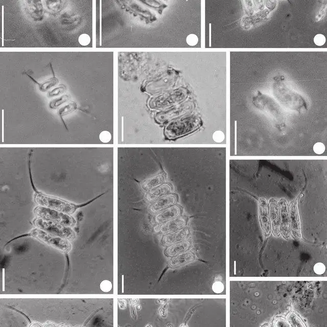 Figura-6-a-Desmodesmus-costato-granulatus-var-elegans-b-D-granulatus-c-D_Q640.jpg