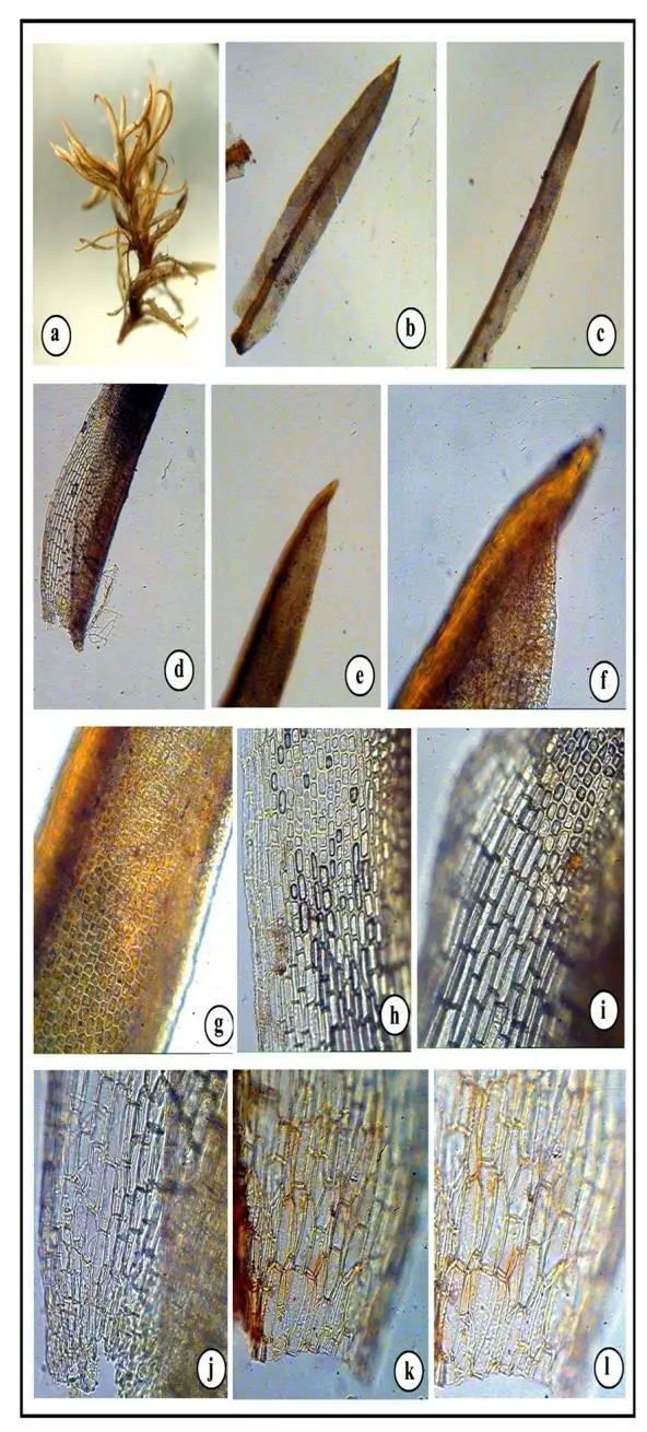 Figure-3-Oxystegus-cylindrothecus-Mitt-Gangulee-a-habit-b-c-leaf-d-leaf-base.png