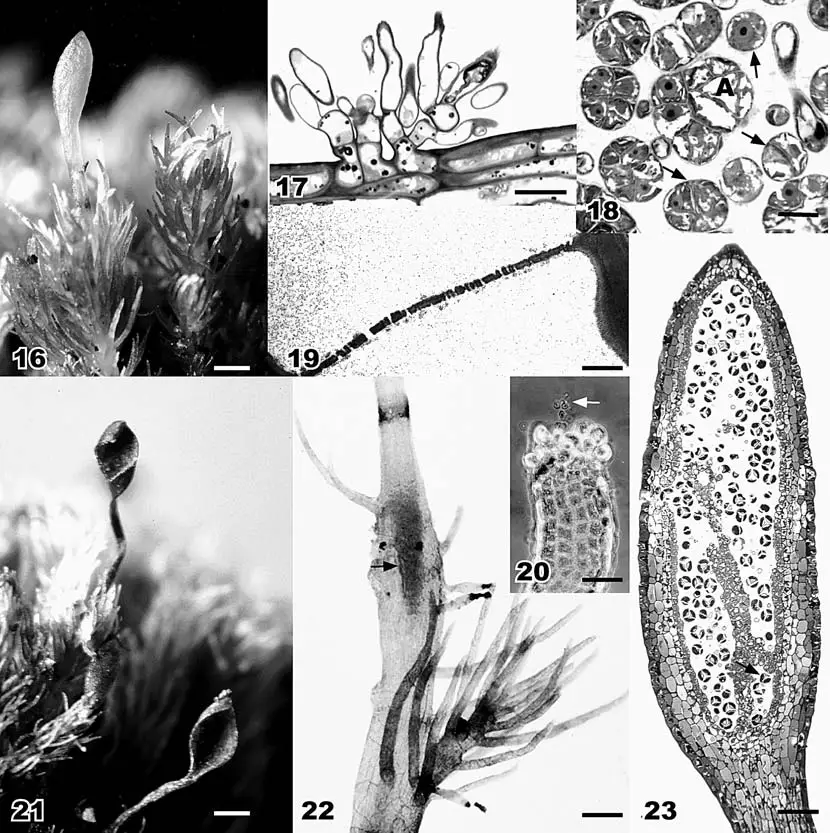 Figures-16-23-Takakia-ceratophylla-16-Habit-showing-female-gametophyte-with-attached.png