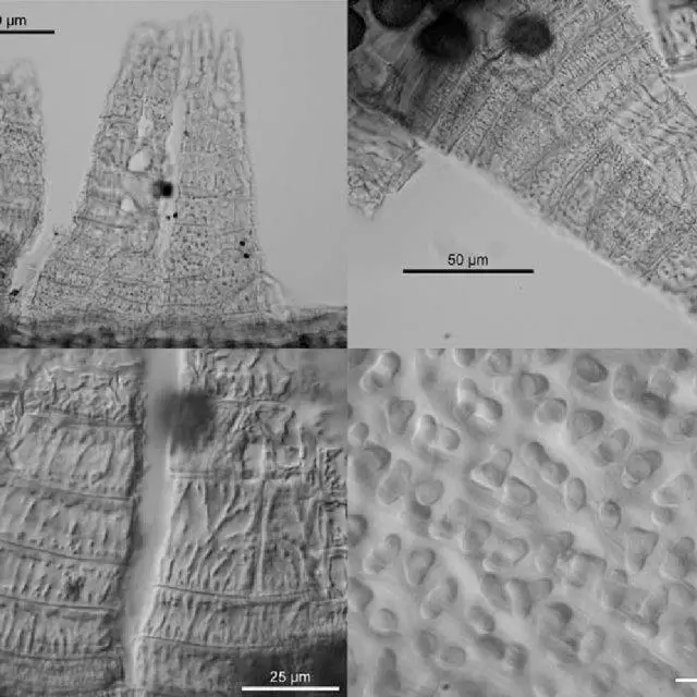 Figures-6-9-Orthotrichum-shawii-6-Partial-view-of-the-exostome-under-bright-field_Q640.jpg