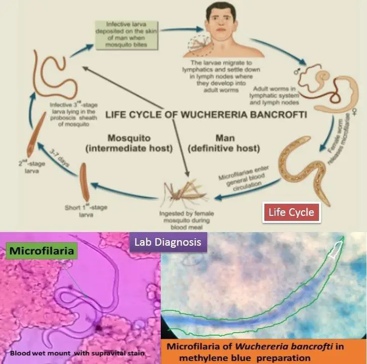 Filariasis-Life-cycle-and-lab-diagnosis.jpg