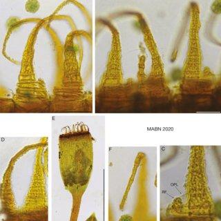 Fissidens-cyathaeicola-Brugg-Nann-A-OPL-of-two-teeth-The-left-tooth-with-rudimentary_Q320.jpg