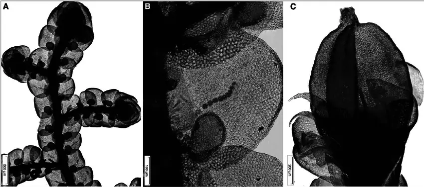 Gametophyte-morphology-of-Frullania-asagrayana-A-Ventral-view-showing-lobules-of-the.png