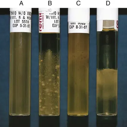 Growth-Characteristics-of-Various-Bacteria-in-tholgycollate-broth.jpg