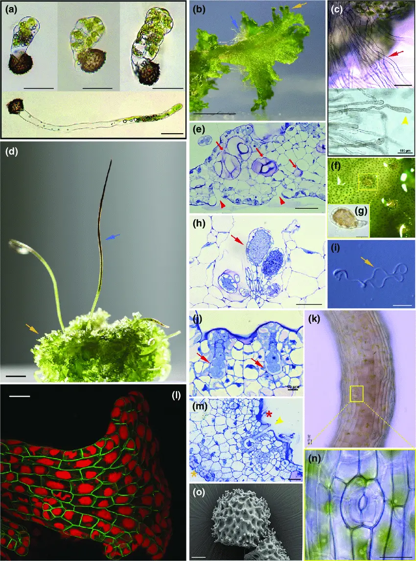 Key-morphological-features-of-Anthoceros-agrestis-a-Light-micrograph-LM-of.png