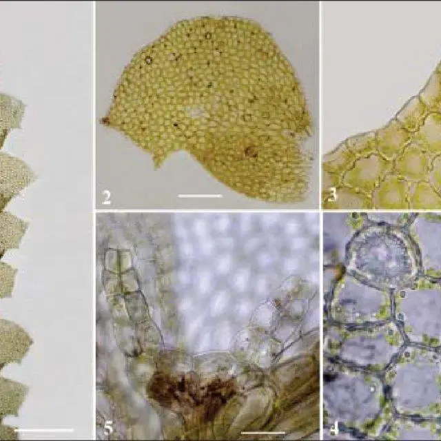 Leptolejeunea-apiculata-Horik-SHatt-1-A-portion-of-plant-in-ventral-view-2-A_Q640.jpg