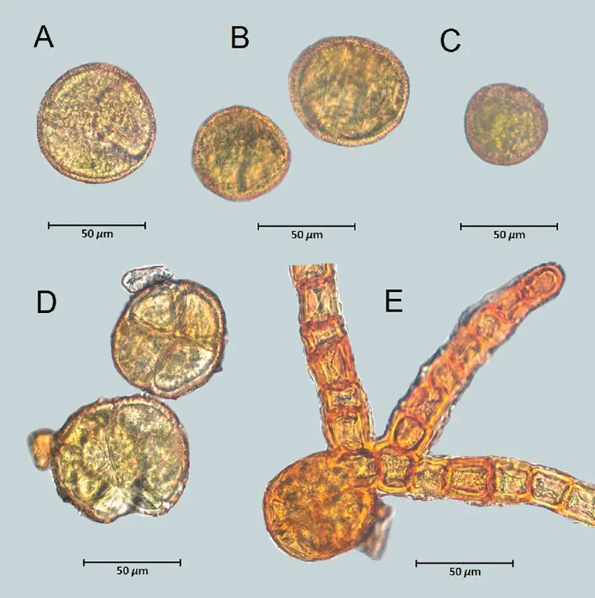 Macrocoma-abyssinica-MuellHal-Vitt-var-abyssinica-A-C-Unicellular-spores.png