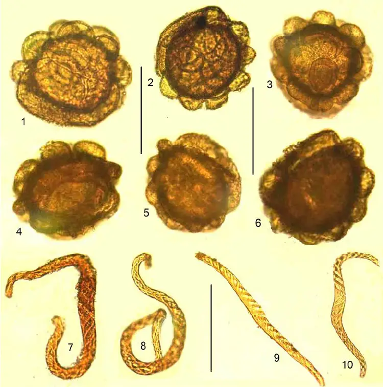 Mannia-androgyna-L-A-Evans-1-3-5-6-distal-face-of-spores-4-proximal-face.png