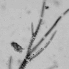 Microspora-tumidula-Fig-6-Stigeoclonium-attenuatu_Q320.jpg