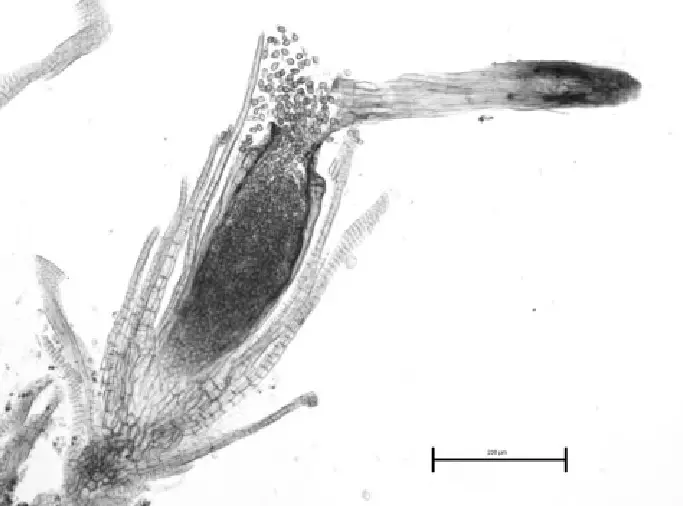 Microtome-preparation-of-a-Gymnostomum-viridulum-shoot-infected-by-the-fungal-parasite.png