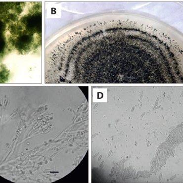 Morphological-features-of-Paramyrothecium-roridum-A-sporodochia-B-colony-morphology_Q640.jpg