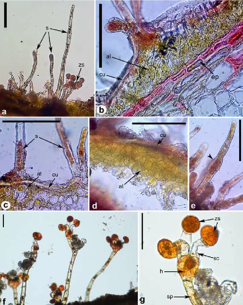 Morphology-of-Cephaleuros-virescens-a-algal-thallus-on-leaf-of-Ficus-benjamina-with.png