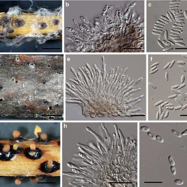 Morphology-of-Diaporthe-bicincta-a-c-D-celastrina-d-f-D-helicis-g-i-a_Q640.jpg