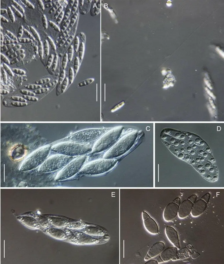 Morphology-on-natural-substrates-asci-and-ascospores-A-B-Plagiostoma-devexum-BPI.png