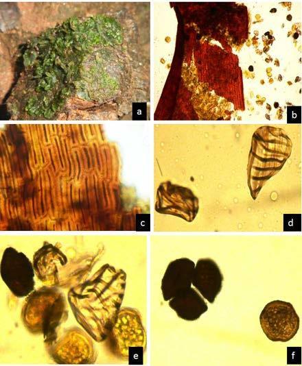 Notothylas-levieri-Schiffn-Ex-Steph-a-Thalii-B-c-capsule-wall-d-f-Spores-and-pseudo.png