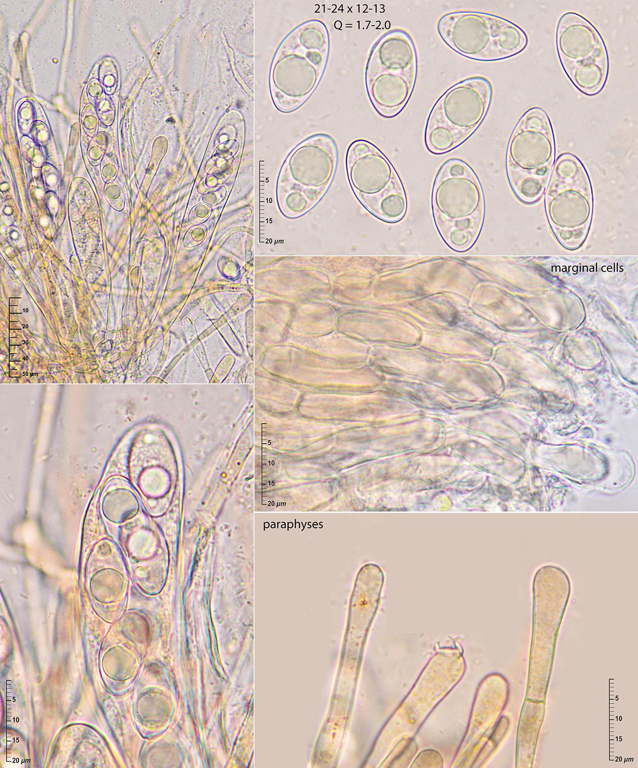 Octospora-leucoloma.-Micrografia.-Salcedo-Quiros-21-I-2016-Bryum-argenteum.jpg