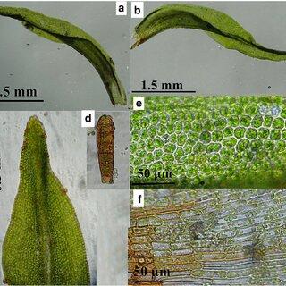 Orthotrichum-hookeri-a-b-Leaves-c-Apex-of-leaf-d-Gemma-e-Median-leaf-cells-f_Q320.jpg