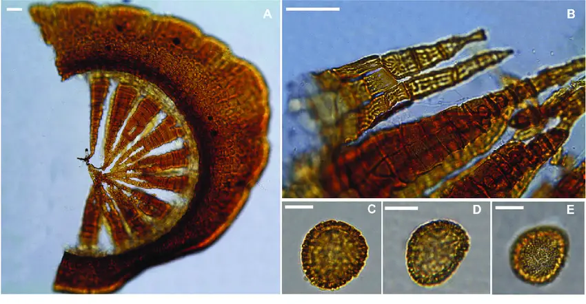 Philonotis-esquelensis-A-Peristome-B-Exostome-and-endostome-in-detail-C-Spore-in.png