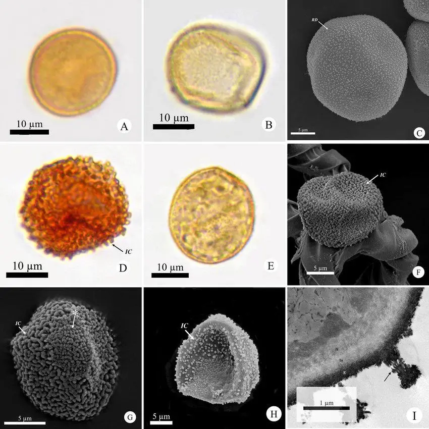 Photomicrographs-and-electromicrographs-of-spores-of-species-of-Plagiochila-Dumort.jpg