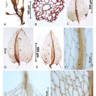 Plagiobryum-zieri-Dicks-ex-Hedw-Lindb-A-Habit-B-Cross-section-of-stem-C-E_Q320.jpg