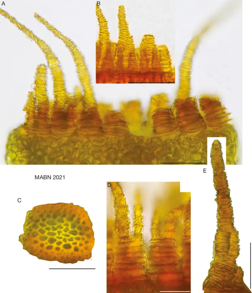 Pristome-variations-of-Fissidens-pocsii-Bizot-Dury-ex-Pocs-s-lato-A-OPL-trabeculae.png