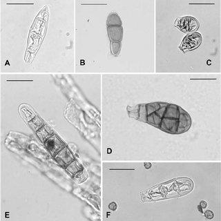 Propagula-A-Zygodon-reinwardtii-Ule-131-G-B-Z-jaffuelii-RP-6-2285-1b-MO_Q320.jpg