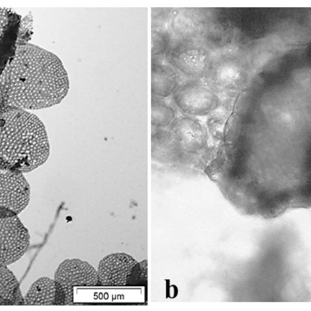 Pycnolejeunea-chocoensis-MEReiner-Gradst-a-gametophyte-ventral-view-b-leaf_Q640.jpg