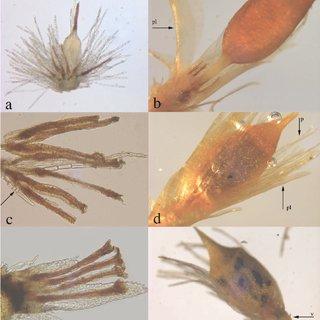 Reproductive-branch-and-mature-sporophyte-of-N-nitidula-a-Fertile-archegonium-with_Q320.jpg