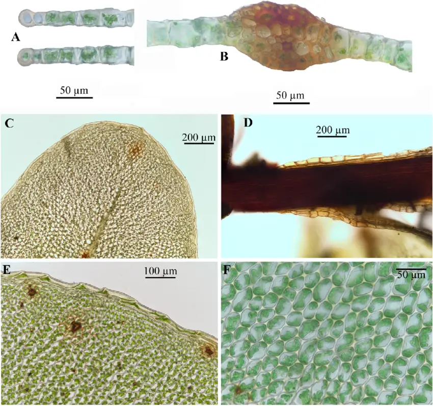 Rhizomnium-mieheanum-Frank-Muell-TJKop-A-Cross-section-of-leaf-border-B.png