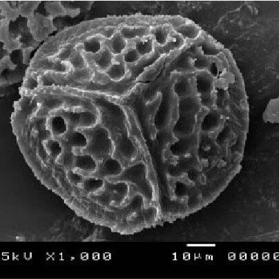 Riccia-cavernosa-Hoffm-SEM-image-of-proximal-face-of-spore-from-Herb-GM-Dirkse-14140_Q640.jpg