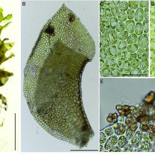 Scapania-apiculata-Spruce-A-shoot-B-leaf-C-D-median-leaf-cells-and-oil-bodies-E_Q320.jpg