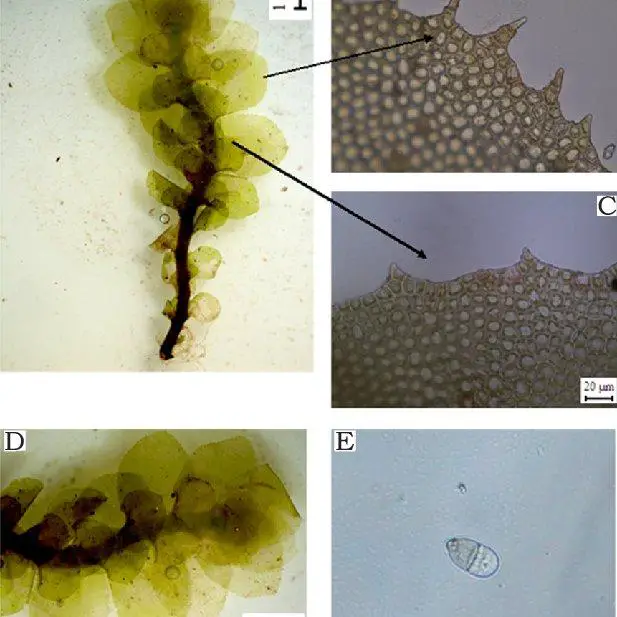 Scapania-gracilis-A-sterile-shoot-antical-view-B-leaf-margin-of-antical-lobe-C_Q640.jpg