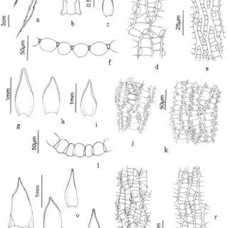 Sphagnum-aciphyllum-MuellHal-a-Fascicle-b-Stem-leaf-c-Branch-leaf-d-Branch-leaf_Q320.jpg