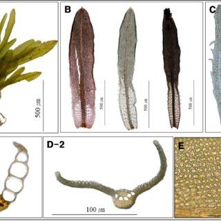 Syrrhopodon-armatus-Mitt-A-Plant-B-Leaves-C-Basal-part-of-leaf-D-Cross-section-of_Q320.jpg