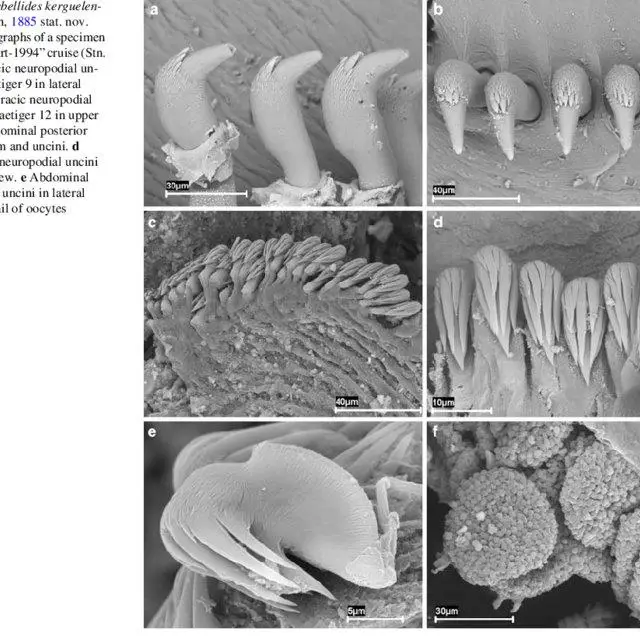 Terebellides-kerguelensis-McIntosh-1885-stat-nov-SEM-micrographs-of-a-specimen-from_Q640.jpg