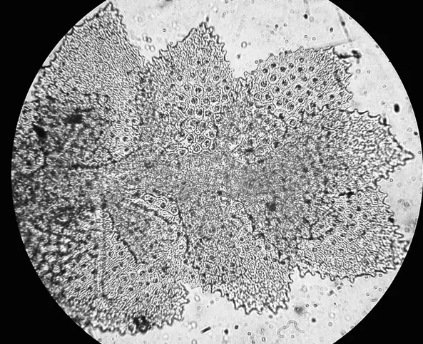 The-rare-Southeast-African-Cololejeunea-mocambiquensis-SWArnell-from-the-area.png