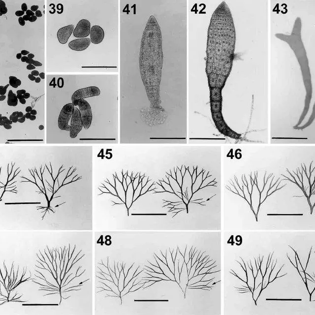 Transverse-section-of-a-tetrasporangium-subtended-by-two-stalk-cells-Fig-36-Young_Q640.jpg