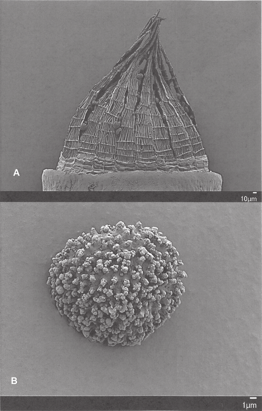 Trematodon-brachyphyllus-A-SEM-of-spore-B-SEM-of-peristome-Scale-Bars-10-mm-for.png