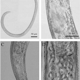 Tylenchorhynchus-shimizui-n-sp-A-C-A-Body-habitus-B-Oesophageal-basal-bulb-C_Q320.jpg