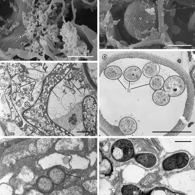 Typical-features-of-glomeromycote-associations-in-thalloid-liverworts-A-B-Scanning_Q640.jpg