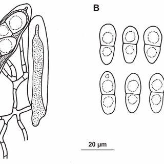 Zwackhiomyces-echinulatus-holotype-A-Mature-ascus-young-ascus-and-hamathecial_Q320.jpg